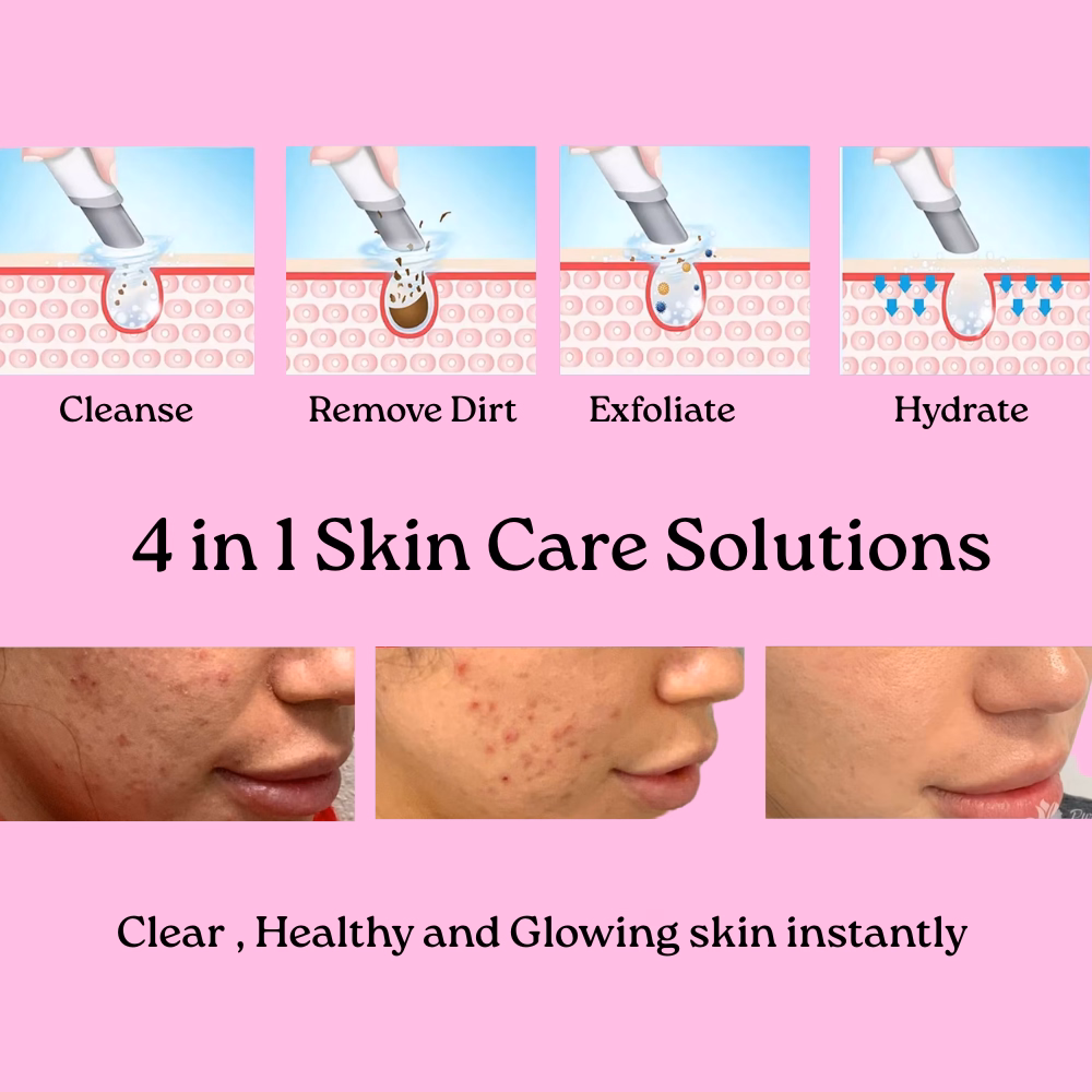 4 in 1 Skin Care Solutions