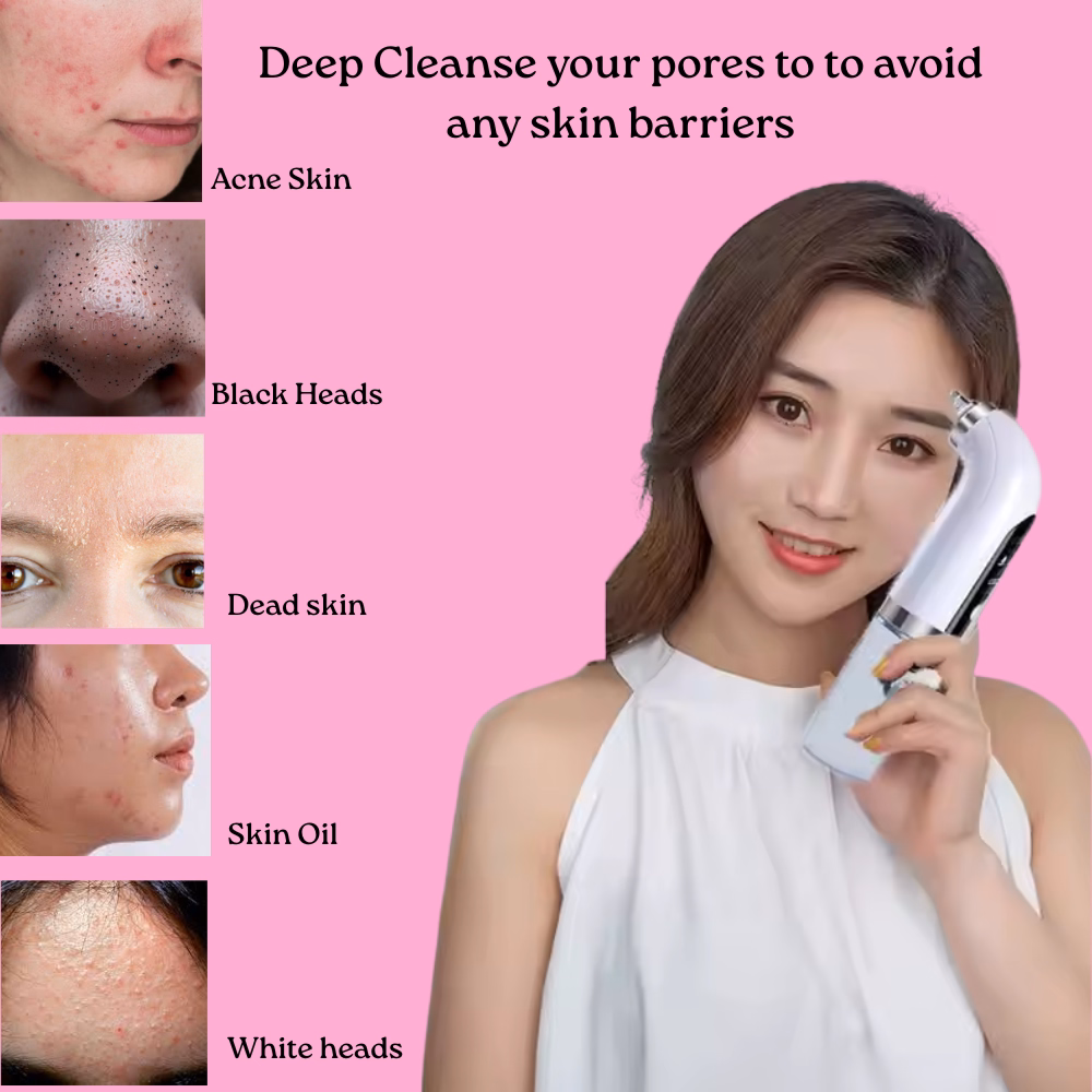 Acne Skin