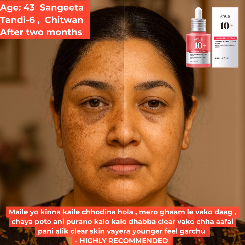 Age 43 Sangeeta - Narayanghathello