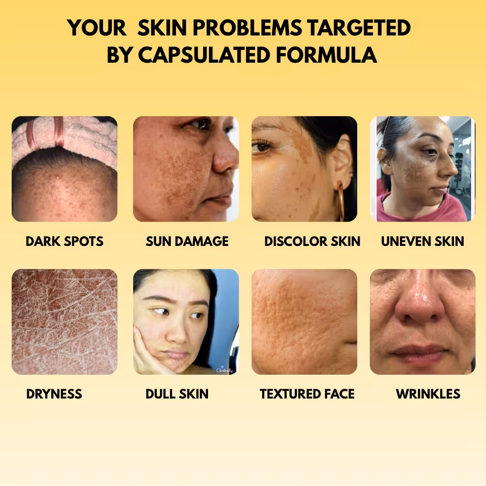 MANY SKIN PROBLEMS TARGET BY ONE CREAM